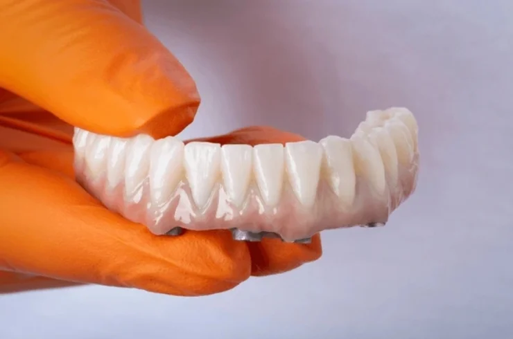Dental Implants with Zirconia Crowns