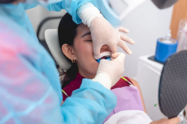 Fluoride Application and Counselling